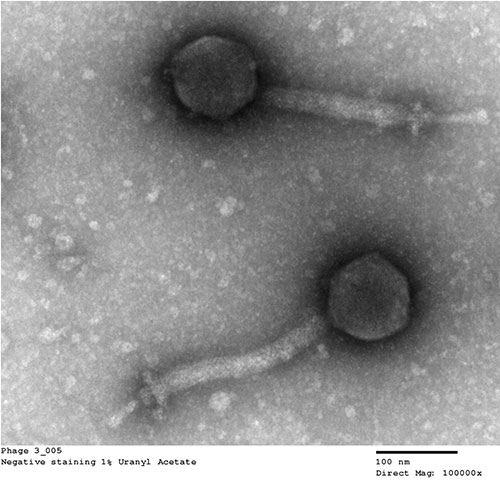 Phage under a microscope.